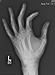 my hand x-ray - click to enlarge